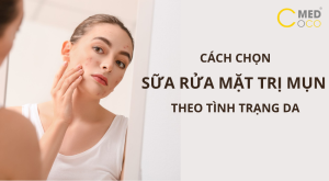 Cách chọn sữa rửa mặt trị mụn theo tình trạng da