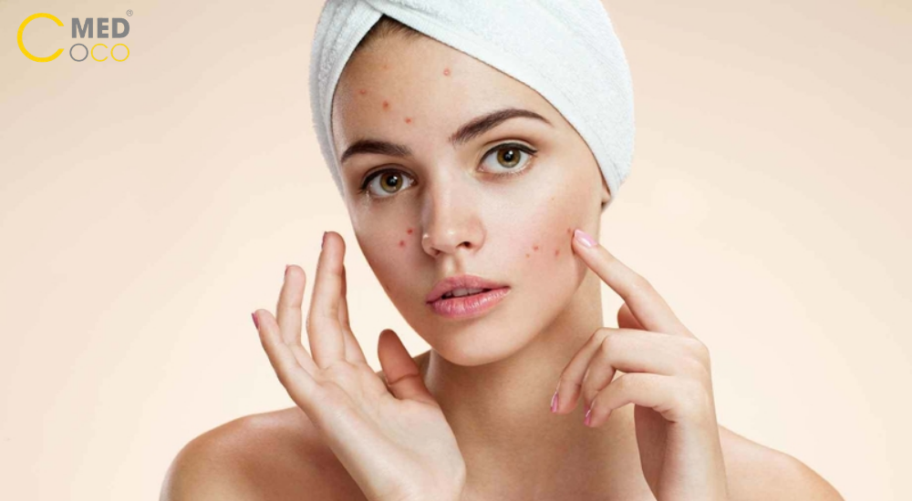 top sữa rửa mặt cho da dầu mụn được đánh giá cao