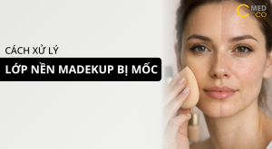 Cách xử ký lớp nền makeup bị mốc