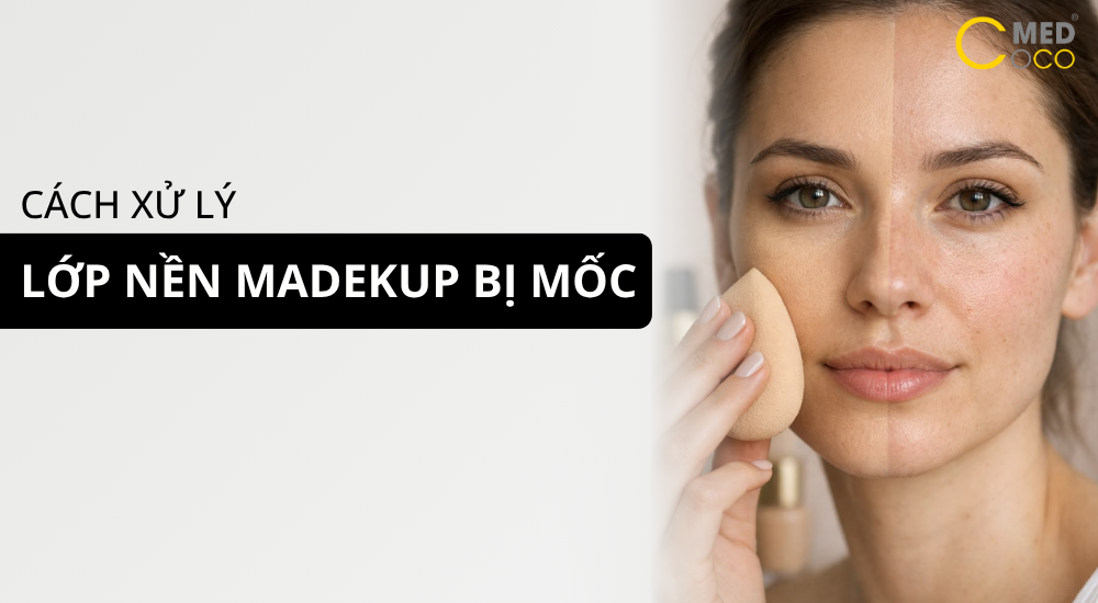 Cách xử ký lớp nền makeup bị mốc