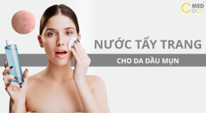 Cách chọn nước tẩy trang cho da dầu mụn